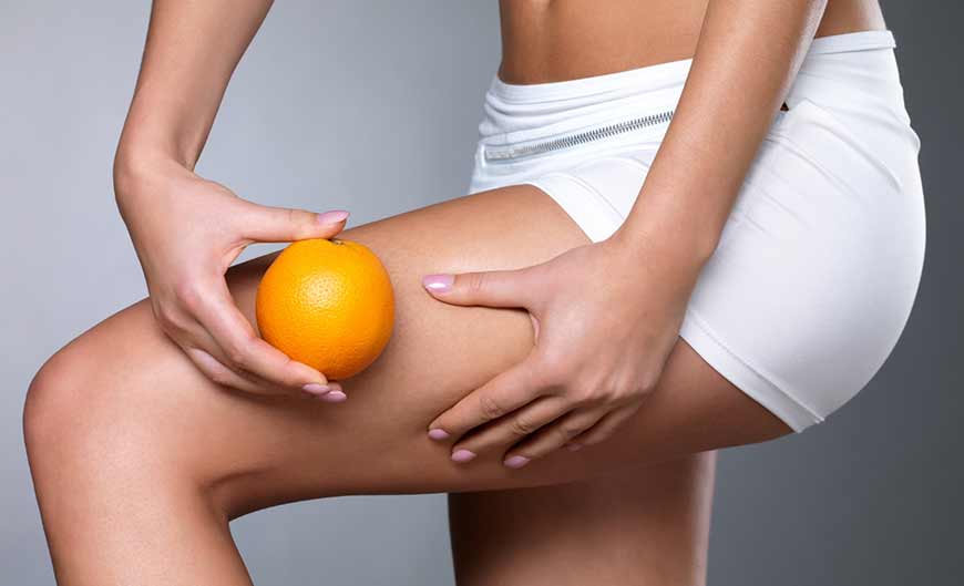 Narancsbőr elleni kezelés, anti-cellulit kezelések